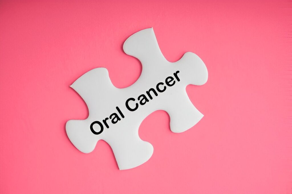 Oral Cancer Screening