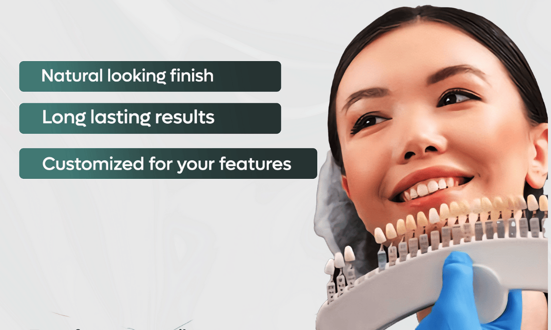 Fillings vs Crowns vs Bonding
